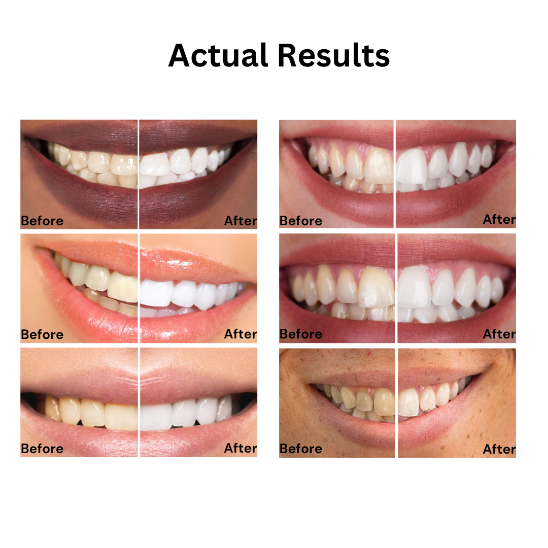 Whitening Niacinamide Toothpaste